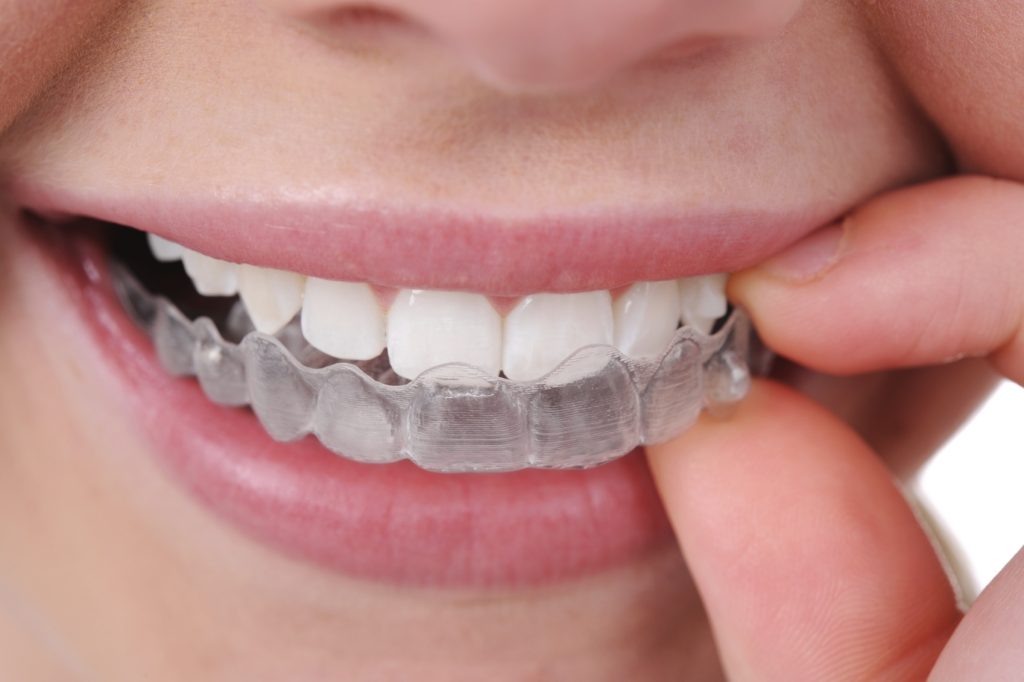 Learn more about Invisalign