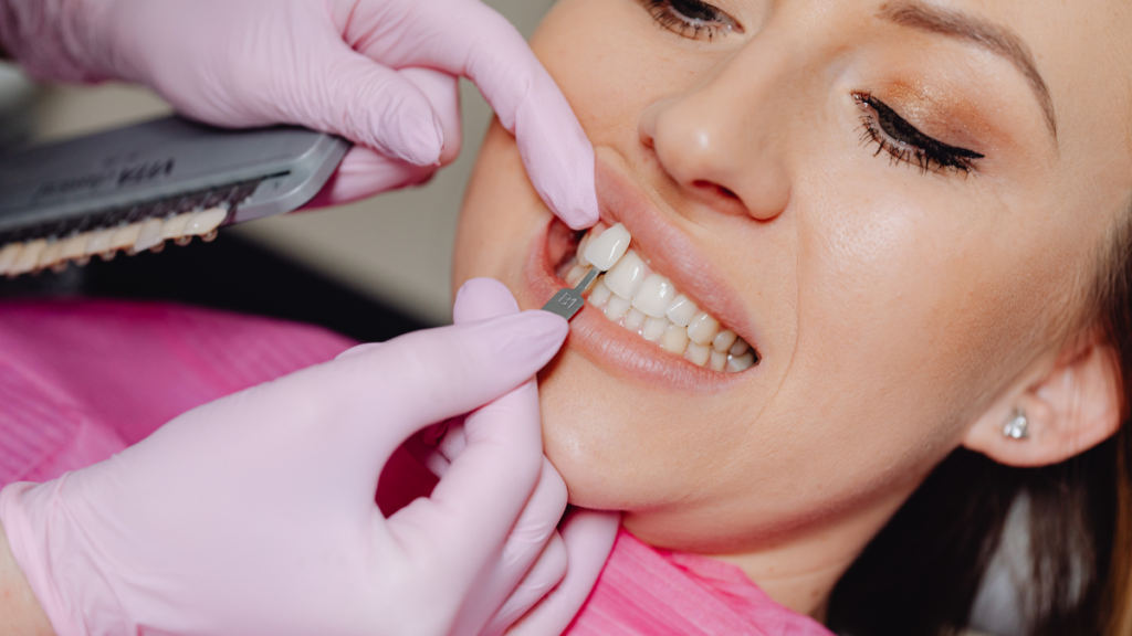 Dentist placing porcelain veneers to enhance a patient’s smile at Broad St Smiles in San Luis Obispo, CA.