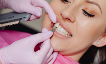 Dentist placing porcelain veneers to enhance a patient’s smile at Broad St Smiles in San Luis Obispo, CA.
