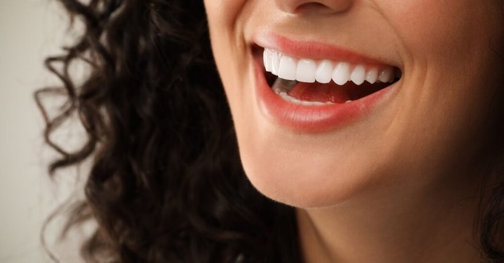 Close-up of a woman smiling, showing bright porcelain veneers.